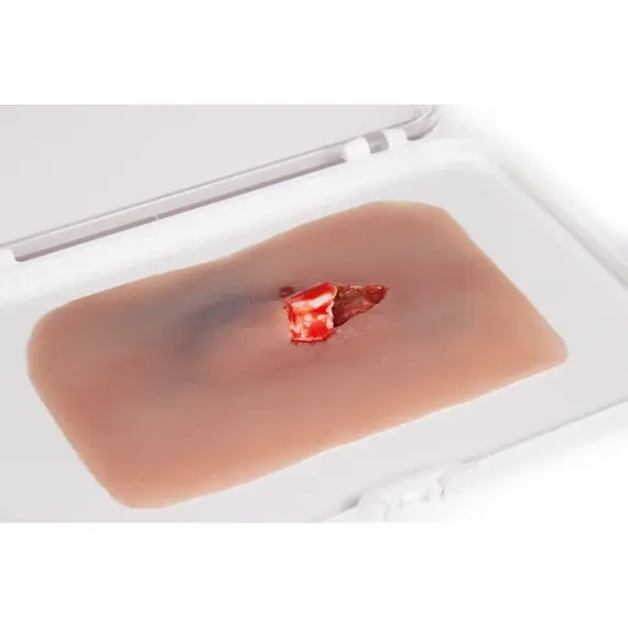 Εκπαιδευτικό Ομοίωμα Ανοιχτού Κατάγματος