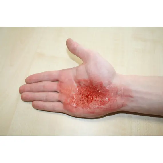 Εκπαιδευτικό Σετ Προσομοίωσης Τραυμάτων