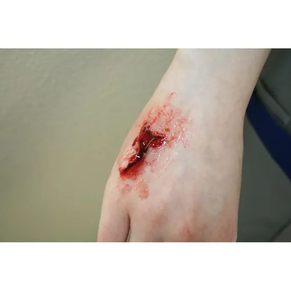 Εκπαιδευτικό Σετ Προσομοίωσης Τραυμάτων