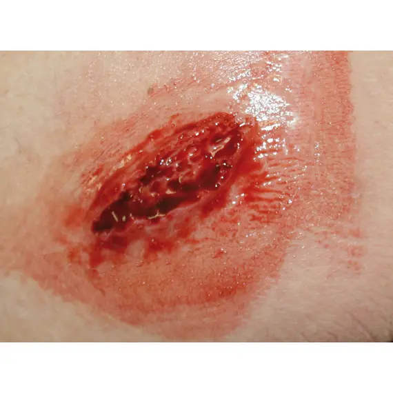 Εκπαιδευτικό Σετ Προσομοίωσης Τραυμάτων