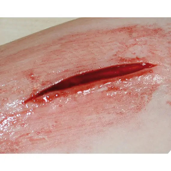 Εκπαιδευτικό Σετ Προσομοίωσης Τραυμάτων